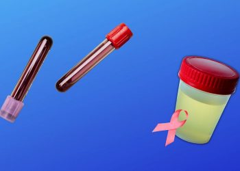 Ucuz yeni bir kan testi, evlilikten önce 14 kanser ameliyatı tespit edebilir